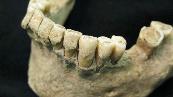 Американские рабочие нашли тайник в стене с тысячей человеческих зубов